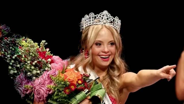 Delaware Teen Makes History as First Miss Teen USA Contestant with Down Syndrome