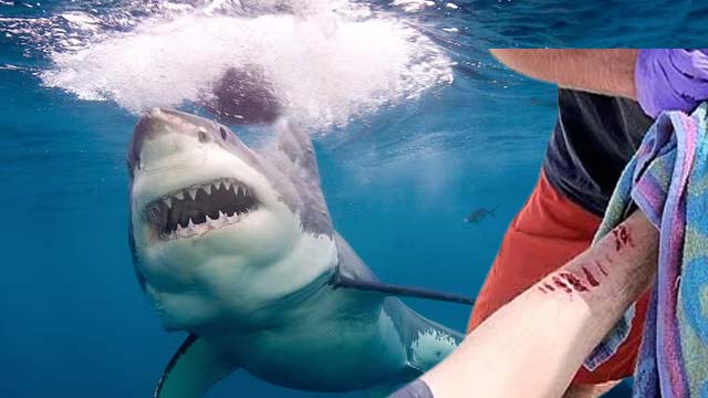 A man recovers after a shark encounter off Florida northeast coast