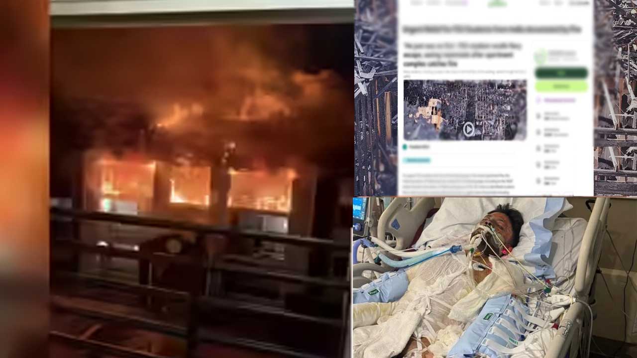 Indian Student Preet Harsoda Battles Severe Burns as FSU Fire Impacts 30 Students