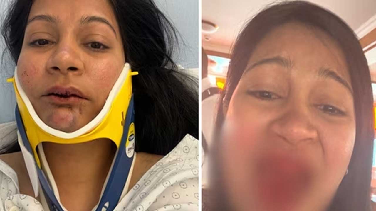 Indian-Origin Couple Brutally Attacked at Swiss Hotel, Story Goes Viral