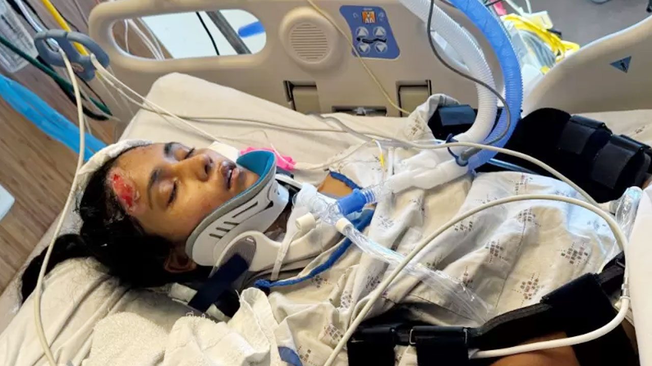 San Jose Fundraiser Launched for Indian-Origin Woman in Coma After Severe Car Crash