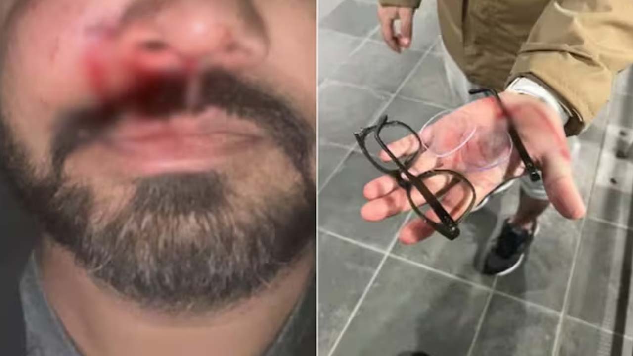 Indian Techie Santosh Yadav Brutally Attacked In Dublin